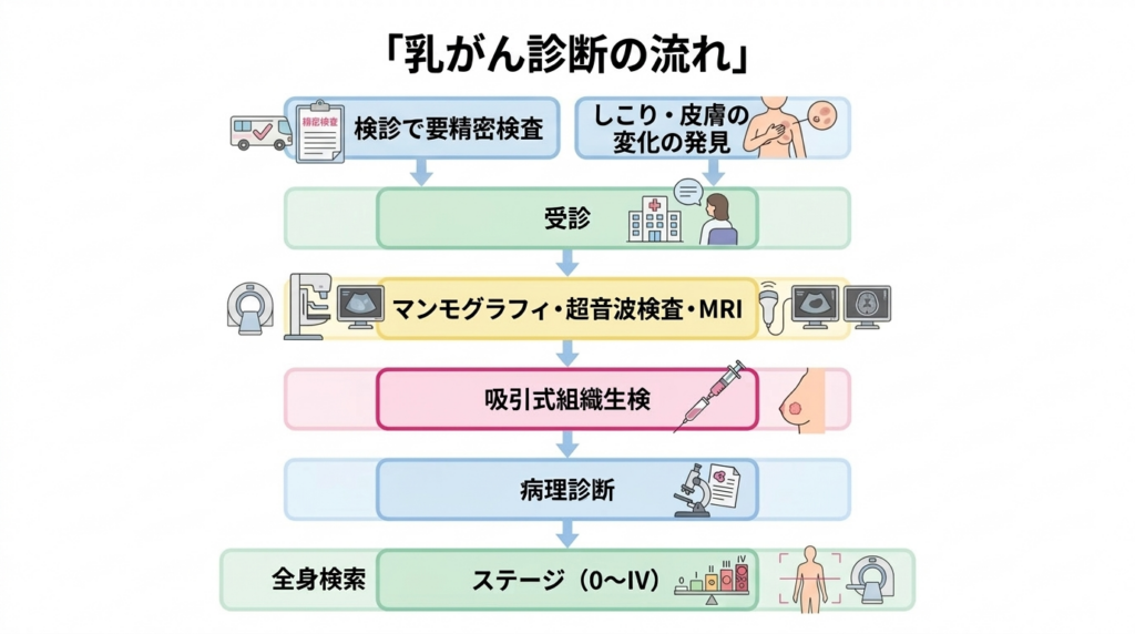 乳がんのステージ分類（0期〜IV期）を示す図解